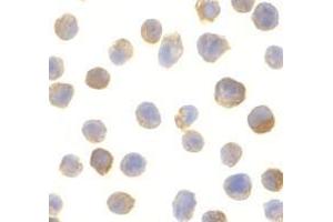 Immunocytochemistry of CTRP2 in Jurkat cells with AP30250PU-N CTRP2 antibody at 10 μg/ml. (C1QTNF2 anticorps)