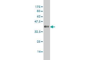 Western Blot detection against Immunogen (36. (CSNK1G1 anticorps  (AA 293-393))