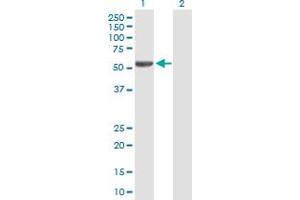 Western Blot analysis of IRX2 expression in transfected 293T cell line by IRX2 MaxPab polyclonal antibody. (IRX2 anticorps  (AA 1-471))