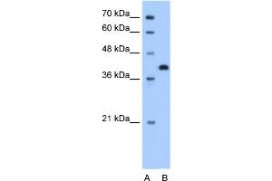 WB Suggested Anti-TOR2A Antibody Titration:  1. (TOR2A anticorps  (N-Term))