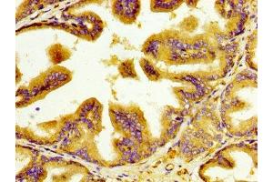 IHC image of ABIN7156356 diluted at 1:400 and staining in paraffin-embedded human prostate tissue performed on a Leica BondTM system.