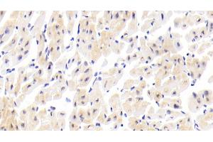 Detection of ATP2A2 in Human Cardiac Muscle Tissue using Polyclonal Antibody to ATPase, Ca++ Transporting, Cardiac Muscle, Slow Twitch 2 (ATP2A2)