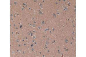 Used in DAB staining on fromalin fixed paraffin- embedded brain tissue