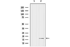 anti-Single-Stranded DNA Binding Protein 1 (SSBP1) (Internal Region) antibody