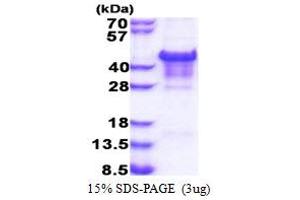 SDS-PAGE (SDS) image for Carbonic Anhydrase XIV (CA14) (AA 16-290) (Active) protein (His tag) (ABIN5853447)