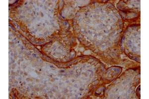 IHC image of ABIN7127578 diluted at 1:100 and staining in paraffin-embedded human placenta tissue performed on a Leica BondTM system.