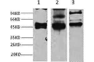 Western blot analysis of 1) Hela, 2) MCF7, 3) 293T, diluted at 1:2000. (KRT17 anticorps)