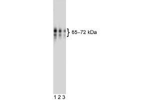 Western blot analysis of human CD110 (Thrombopoietin receptor) expressed by human HEL92. (MPL anticorps  (Extracellular Domain))