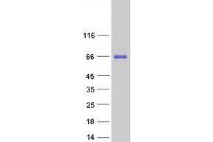 Validation with Western Blot