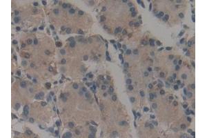 Detection of CALU in Human Stomach Tissue using Polyclonal Antibody to Calumenin (CALU)