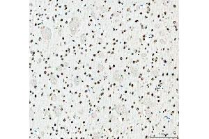 IHC analysis of SFPQ using anti-SFPQ antibody (ABIN7603089). (SFPQ anticorps  (Middle Region))