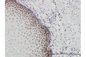 Immunoperoxidase of monoclonal antibody to PER2 on formalin-fixed paraffin-embedded human esophagus.