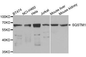Western blot analysis of extracts of various cell lines, using SQSTM1 antibody. (SQSTM1 anticorps)