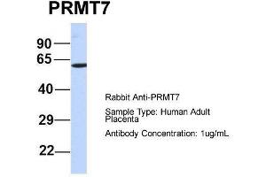 Host:  Rabbit  Target Name:  PRMT7  Sample Type:  Human Adult Placenta  Antibody Dilution:  1. (PRMT7 anticorps  (N-Term))