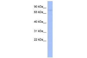 WB Suggested Anti-ZNF219 Antibody Titration:  0. (ZNF219 anticorps  (Middle Region))