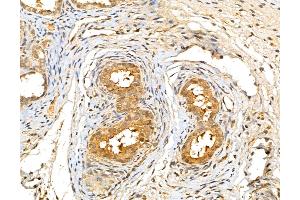ABIN7094343 and ABIN7098390 at 1/100 staining Rat ovary tissue by IHC-P.