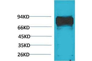 Western Blotting (WB) image for anti-V-Raf-1 Murine Leukemia Viral Oncogene Homolog 1 (RAF1) antibody (ABIN3181567) (RAF1 anticorps)