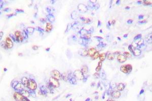 Image no. 1 for anti-X-Ray Repair Complementing Defective Repair in Chinese Hamster Cells 3 (XRCC3) antibody (ABIN271981) (XRCC3 anticorps)