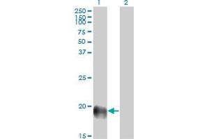 Western Blot analysis of ESM1 expression in transfected 293T cell line by ESM1 monoclonal antibody (M02), clone 6D4. (ESM1 anticorps  (AA 85-184))