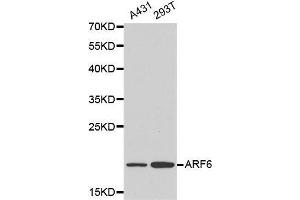 Western blot analysis of A431 cell and 293T cell lysate using ARF6 antibody. (ARF6 anticorps  (AA 1-175))