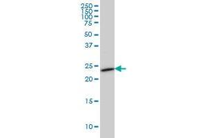 SEC22L1 monoclonal antibody (M01), clone 1E1 Western Blot analysis of SEC22L1 expression in HeLa .