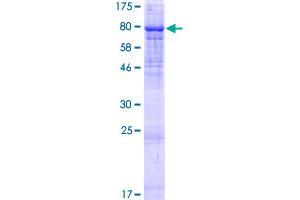 PIP5K1B Protein (AA 1-549) (GST tag)