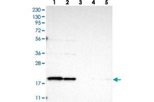 Western blot analysis of Lane 1: RT-4, Lane 2: U-251 MG, Lane 3: Human Plasma, Lane 4: Liver, Lane 5: Tonsil with TIMM17B polyclonal antibody . (TIMM17B anticorps)