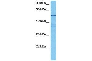 Host:  Mouse  Target Name:  SRC  Sample Tissue:  Mouse Liver  Antibody Dilution:  1ug/ml