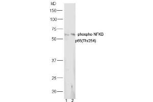 Lane 1: Mouse lung lysates Lane 2: Mouse spleen lysates probed with Rabbit Anti-NFkB p65 (Thr254) Polyclonal Antibody, Unconjugated (ABIN712886) at 1:300 overnight at 4˚C. (NF-kB p65 anticorps  (pThr254))