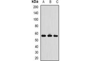 Western blot analysis of TCP1-delta expression in MCF7 (A), THP1 (B), mouse spleen (C) whole cell lysates. (CCT4 anticorps)
