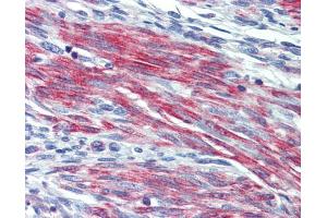 IHC-P Image Immunohistochemical analysis of paraffin-embedded human uterus, myometrium, using GPR40, antibody(10 μg/ml).