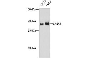 Western blot analysis of extracts of various cell lines, using SREK1 antibody (ABIN6132836, ABIN6148434, ABIN6148435 and ABIN6217160) at 1:3000 dilution. (SFRS12 anticorps  (AA 1-180))
