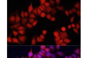 Immunofluorescence analysis of HeLa cells using CSTB Polyclonal Antibody at dilution of 1:100. (CSTB anticorps)
