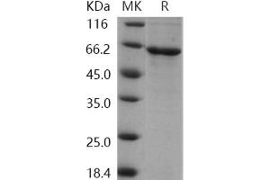 Western Blotting (WB) image for Cyclin Dependent Kinase Like 2 (CDKL2) protein (His tag) (ABIN7195300)