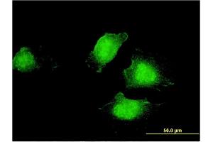 Immunofluorescence of monoclonal antibody to EDC4 on HeLa cell.