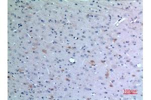 Immunohistochemistry (IHC) analysis of paraffin-embedded Rat Brain, antibody was diluted at 1:100. (CCL26 anticorps  (Internal Region))