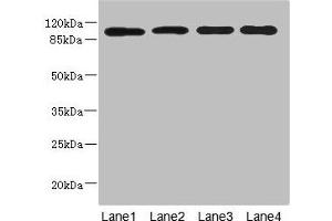 Western blot All lanes: USP26 antibody at 5. (USP26 anticorps  (AA 664-913))