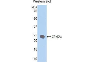 Western blot analysis of the recombinant protein. (Cytokeratin 1 anticorps  (AA 350-488))