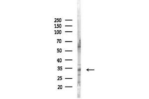 anti-Sulfotransferase Family 1E Member 1 (SULT1E1) (Internal Region) antibody
