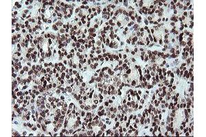 Image no. 3 for anti-Fetal and Adult Testis Expressed 1 (FATE1) antibody (ABIN1498222)