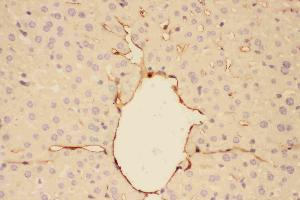 IHC analysis of Adiponectin using anti-Adiponectin antibody . (ADIPOQ anticorps  (AA 19-244))