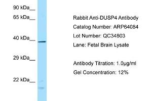 Western Blotting (WB) image for anti-Dual Specificity Phosphatase 4 (DUSP4) (N-Term) antibody (ABIN2789727) (DUSP4 anticorps  (N-Term))