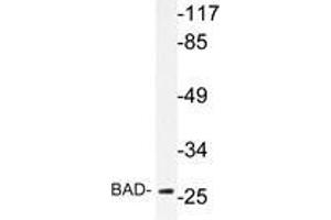 Western blot analysis of BAD antibody in extracts from NIH/3T3 cells. (BAD anticorps)