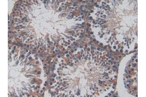 anti-Protein C Receptor, Endothelial (PROCR) (AA 32-167) antibody