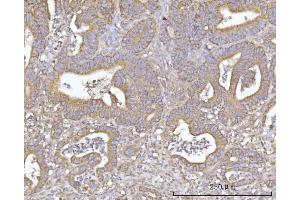 IHC analysis of SLU7 using anti-SLU7 antibody (ABIN7601697). (SLU7 anticorps  (AA 42-474))