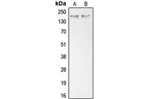 Western blot analysis of Collagen 11 alpha 1 expression in K562 (A), Saos2 (B) whole cell lysates. (COL11A1 anticorps  (Center))