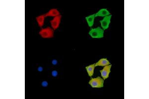 anti-Transmembrane Protein 66 (TMEM66) antibody