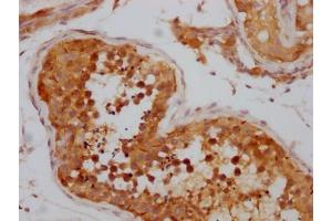 IHC image of ABIN7127650 diluted at 1:100 and staining in paraffin-embedded human testis tissue performed on a Leica BondTM system. (Recombinant NUP98 anticorps)