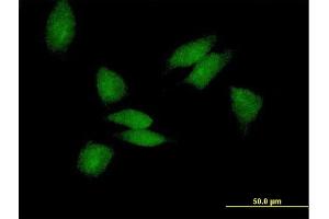 Immunofluorescence of purified MaxPab antibody to PABPC3 on HeLa cell.