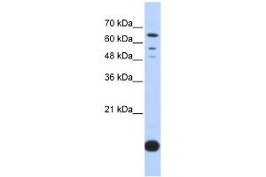 Thioredoxin 2 antibody used at 1 ug/ml to detect target protein. (TXN2 anticorps  (Middle Region))
